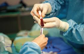 پیوند مغز استخوان تحت پوشش بیمه قرار می‌گیرد